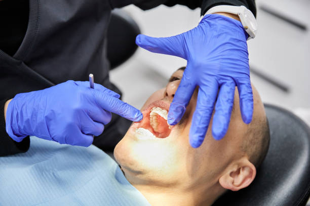 Best Urgent Care for Lost Fillings or Crowns in Saint Johns University, MN