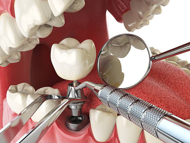 Best After-Hours Dental Trauma Care in Saint Johns University, MN